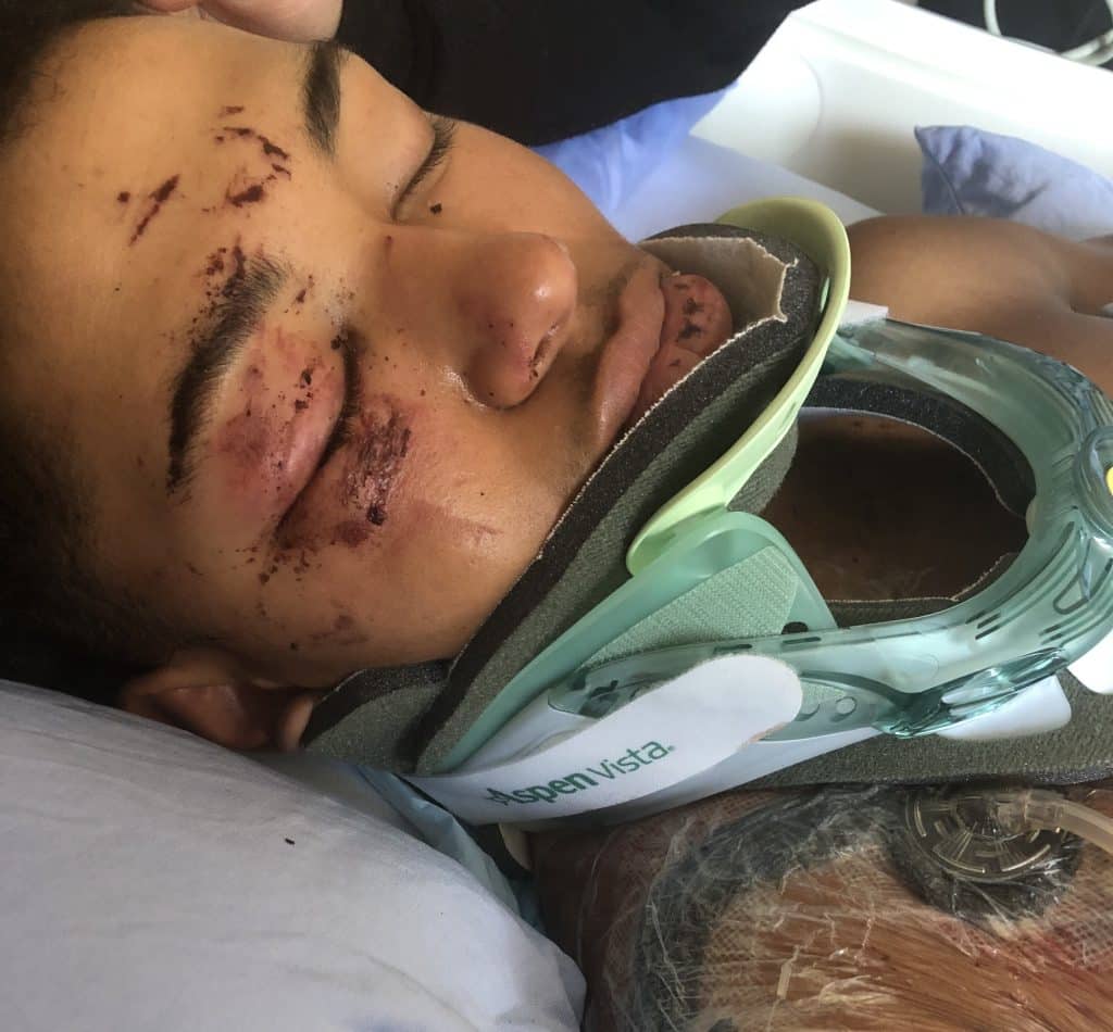 A teenage boy with facial scrapes and a neck brace lies in a hospital bed with 